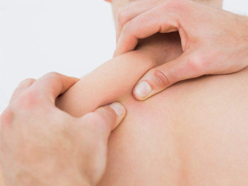 Myofascial Release Therapy in Alpharetta, Johns Creek, & Roswell, GA